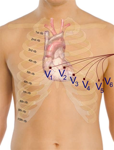 Ecg Leads Heart Hot Sex Picture