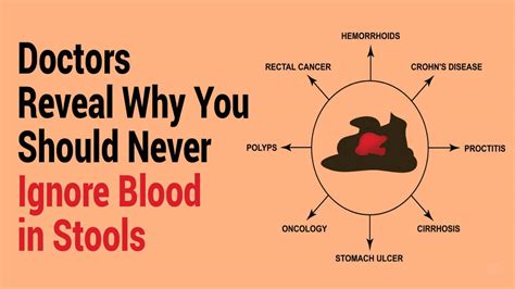 Doctors Reveal Why You Should Never Ignore Blood In Stools