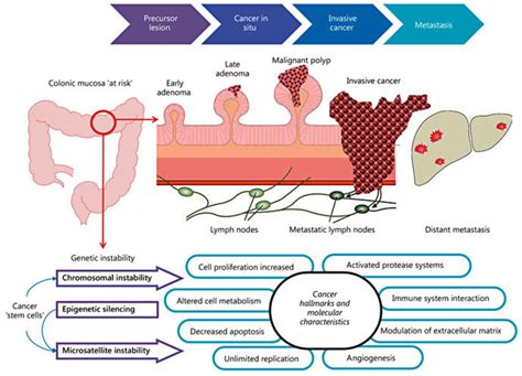 Schematic Depiction Of The Adenoma Carcinoma Metastasis Process The