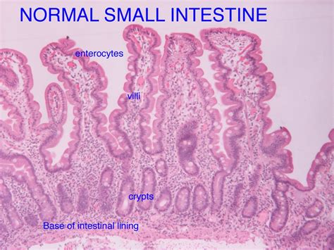 The Food And Gut Journal What Does The Normal Small Intestine Look