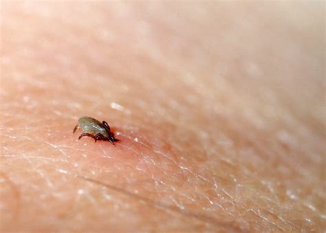 24 Tiny Black Bugs That Bite And Itch And How To Get Rid Of Them