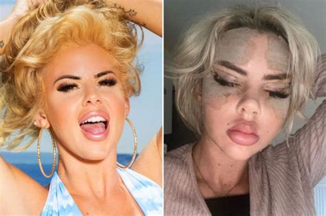 Inside Hannah Elizabeths Surgery Transformation From Love Island Star To Onlyfans Model The