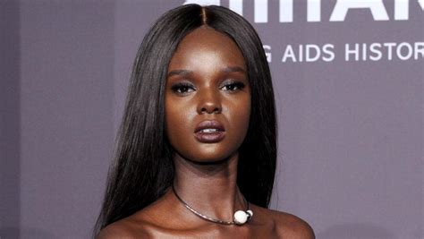 Fenty Beauty Model Reveals She Was In Car Accident 48 Hours Before Her