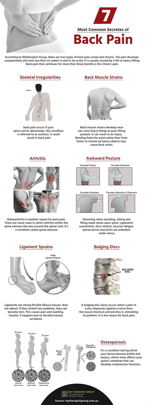 2148 Best Symptoms Of Back Pain Images On Pinterest Fibromyalgia
