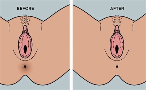 Increased Anal Bleaching Influenced By Porn Porn Dude Blog