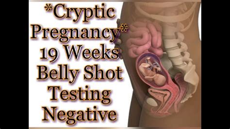 Cryptic Pregnancy19 Weeks Pregnant Testing Negative Belly Shot