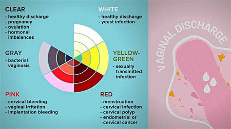 Vaginal Discharge Guide With Color Code Sexiz Pix