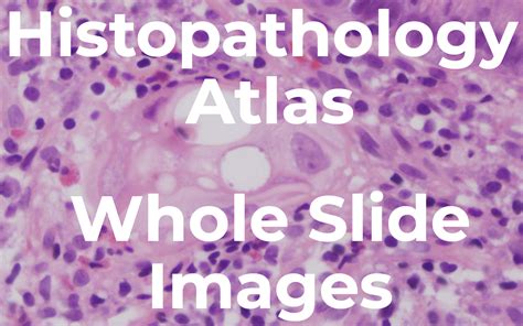 Histopathology Atlas