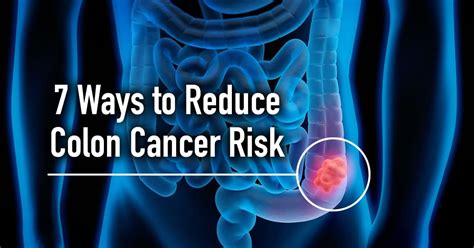 Colon Cancer 7 Ways To Reduce Your Risk Russell Havranek Md