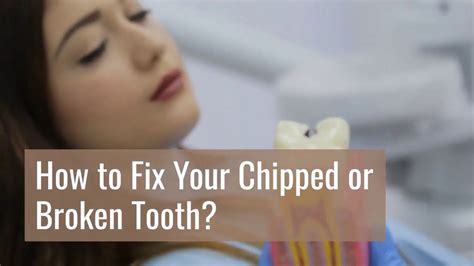 How To Fix Chipped Tooth And What Are The Procedure Tooth Repair