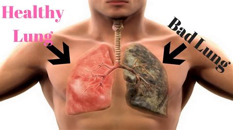 cleanse and rejuvenate smokers lungs how to detox smokers lungs fast youtube