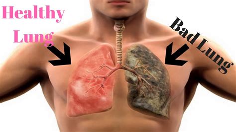 Cleanse And Rejuvenate Smokers Lungs How To Detox Smokers Lungs Fast Youtube