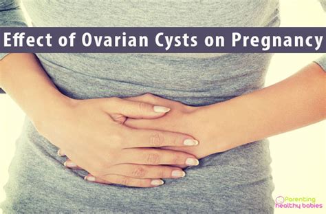 Do Ovarian Cysts Affect Pregnancy Facts You Need To Know