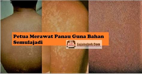 Cara turunkan asid urik dengan ubat gout paling berkesan. Ubat Paling Mujarab Untuk Kayap - Kuching l