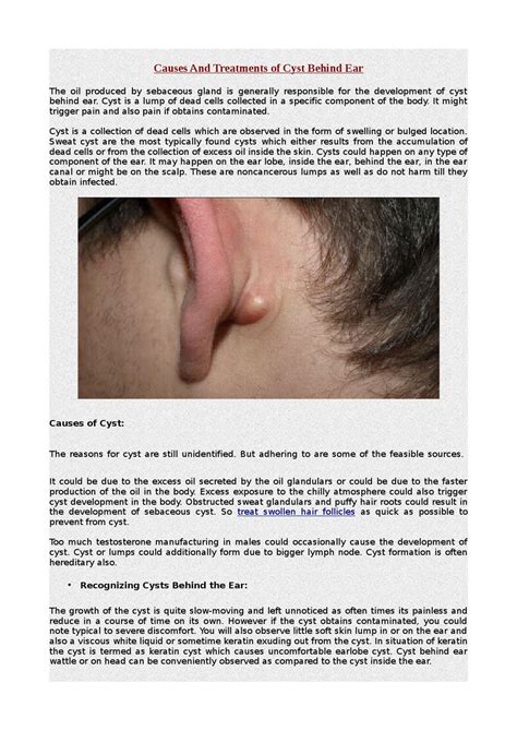 Causes And Treatments Of Cyst Behind Ear By Tyler Thonon Issuu