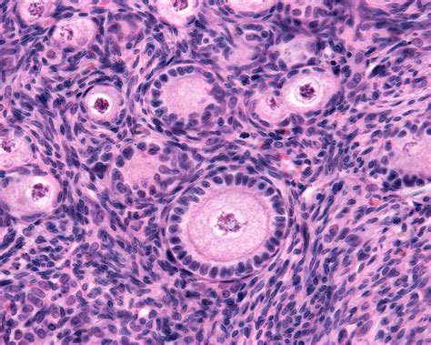 Ovarian Follicles Light Micrograph Stock Image C0456642 Science