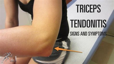 How Long Does Tendonitis Take To Heal In The Elbow Human Body Anatomy