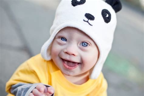 Babies with down syndrome have an extra copy of one of these chromosomes, chromosome 21. Down Syndrome Screening Test: Here's 25,000 Reasons Not To ...