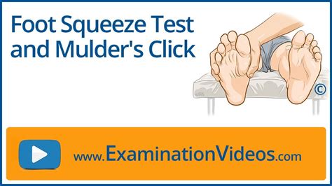 Foot Squeeze Test And Mulders Click Sign Youtube