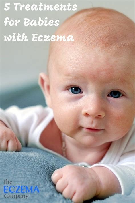 5 Treatments For Babies With Eczema The Eczema Company Oil Treatments