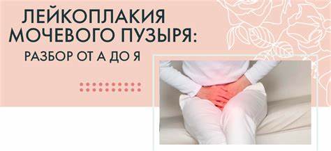 Диета При Лейкоплакии Мочевого Пузыря — Похудение Диета Правильное Питание Картинка - Диета При Лейкоплакии Мочевого Пузыря — Похудение Диета Правильное Питание