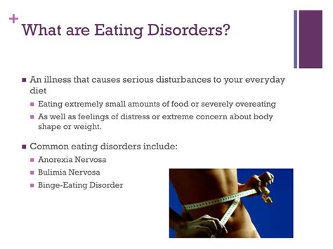 Ppt Eating Disorders Powerpoint Presentation Free Download Id1915001