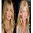 20 Of The Worst Celebrity Plastic Surgery Disasters  ViralCola