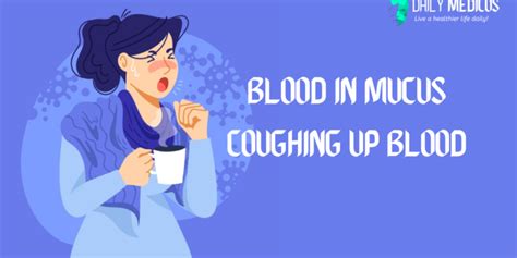 Coughing Up Blood What Blood In Mucus Shows Daily Medicos