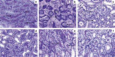 Histopathology Of The Mouse Kidney After Inducing Ischemia