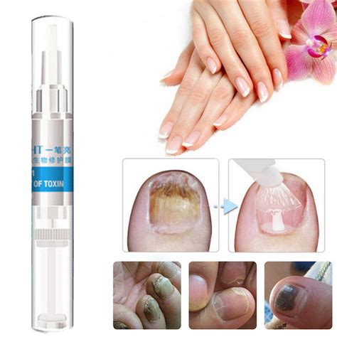 Medications and ointments for treat after that, the surface of the skin under the nail is also affected, but the spread of the fungus will be. 4pcs toenail fungus treatment at Banggood