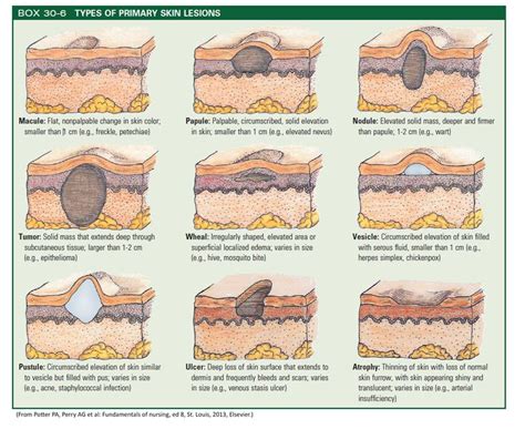 22 Best Skin Lesions Images On Pinterest