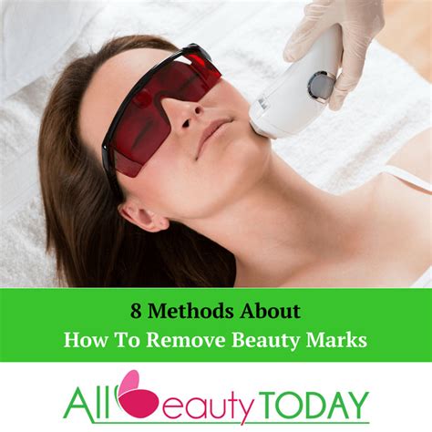 how to remove beauty marks the ultimate guide
