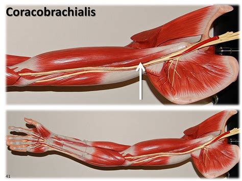 The upper arm is located between the. Coracobrachialis, large arm model - Muscles of the Upper E ...