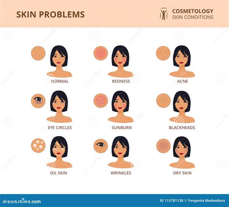 Skin Conditions And Problems Cosmetology Skin Care Stock Vector