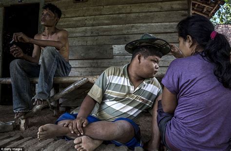 Indonesian Villages Mentally Ill Patients Are Pictured Shackled Or