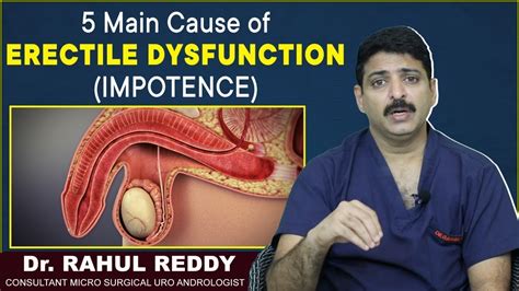 Main Cause Of Erectile Dysfunction Causes Of Impotence Dr Rahul Reddy Androcare