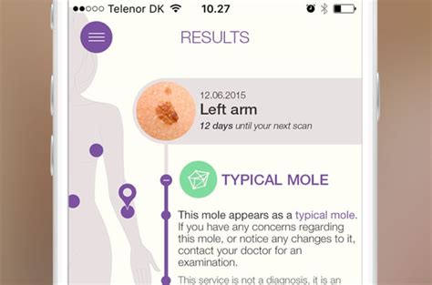 Skinscan Assess And Monitor Your Moles Indiegogo