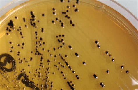 Sigma, usa) with ss agar without novobi after incub ation at 37c for 24 h, the plates. Flashcards - 7. Shigella and Salmonella - Clinical ...