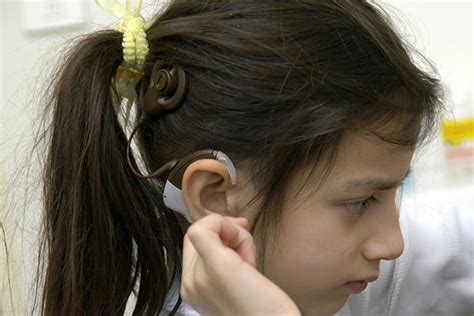 Cochlear Implants A Different Kind Of Hearing
