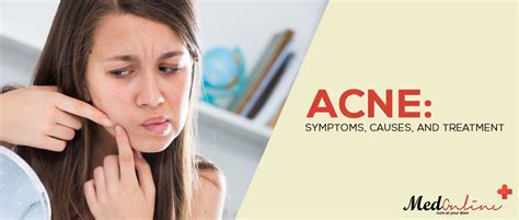 Acne Symptoms Causes And Treatment Medonlinepk