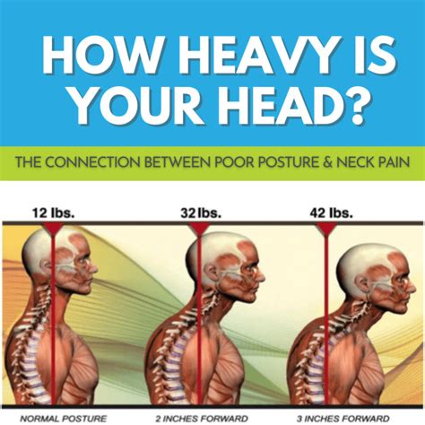 Poor Posture And Neck Pain Melanie Massey Physical Therapy
