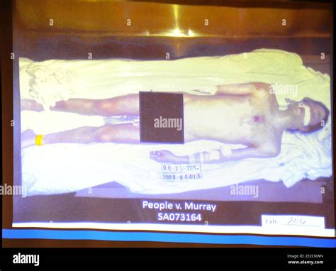 Michael Jackson Autopsy Photo Dead