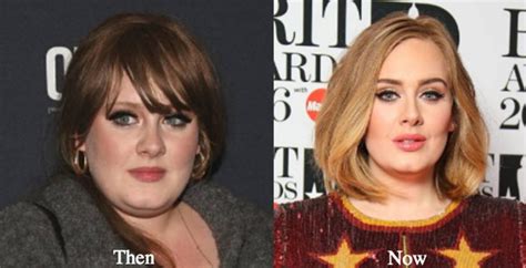 Adeles Before And After Surgery Photos Show Proof Of The Singers Transformation Back Beat Funds