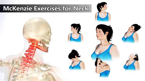 Printable Exercises For Neck Pain Kulturaupice