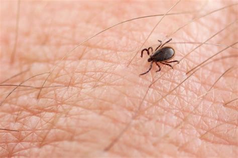 What To Do If Youre Bitten By A Tick The Healthy