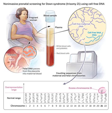 Noninvasive Prenatal Testing Using Fetal Dna Lasker Foundation