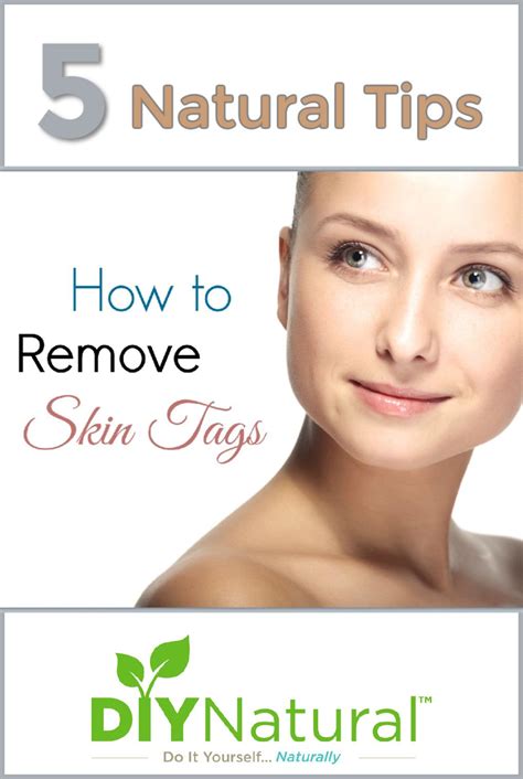 learn these 5 ways to get rid of skin tags naturally skin tag removal skin tag skin