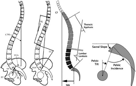 Parameters Of The Sagittal Vertical Axis Sva Relative To The С7pl