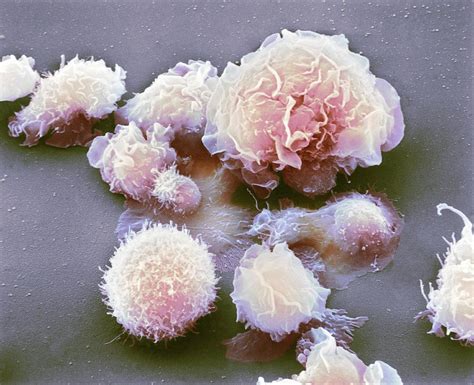 Monocyte White Blood Cells Photograph By Nibsc Pixels