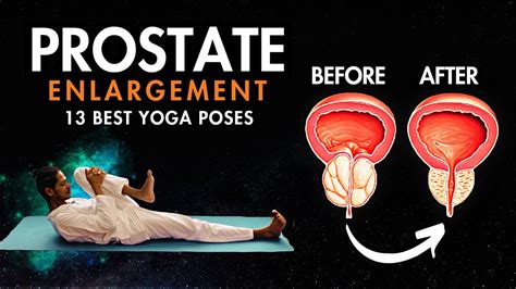 Yoga For Prostate Problems Best Prostate Yoga Exercises Youtube